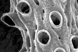 Structure microscopique de Hornera mediterranea, la nouvelle espèce décrite par Jo Harmelin (la barre blanche mesure 0,200 millimètres) © Jo Harmelin